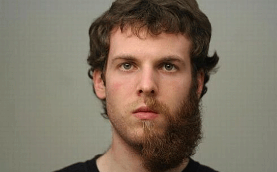 Sarımsak Sakal Çıkarır mı?